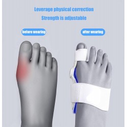 ALINZO Correcteur d'oignon - Attelle orthopédique d'oignon, séparateur de Gros Orteils, soulagement de la Douleur, Correction